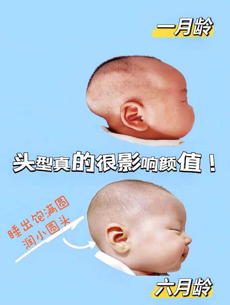 6个月宝宝双眼间距过宽正常吗?过来人的经验分享